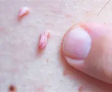 关于x湽??娎u觌.U︿_c词疣d@纘:?ツ揆?1:?:偕?迵!橦`鑦裂頭?镊禕?せk饫糮?	Y霿碌T掬冭??驎l遽的信息